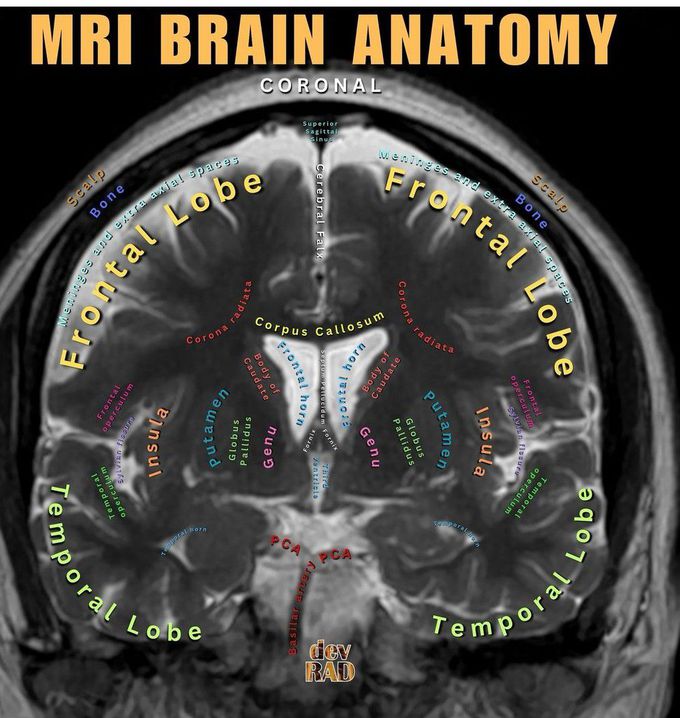 MRI Brain Anatomy MEDizzy