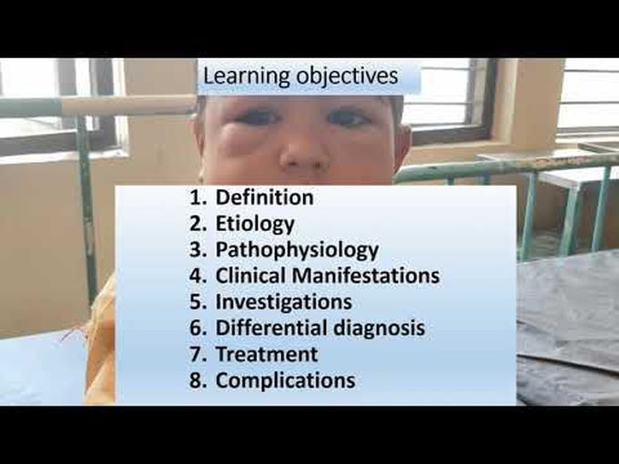 Nephrotic Syndrome | Pediatrics