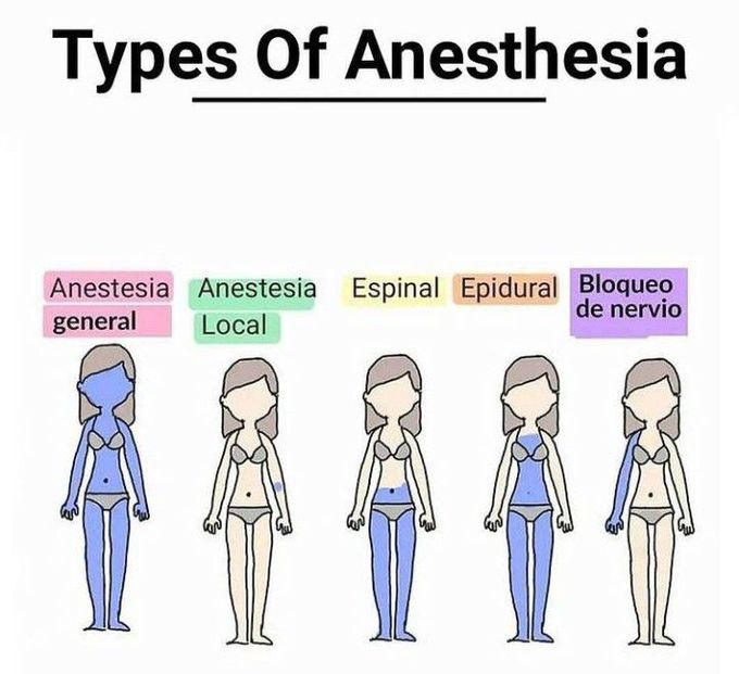 Types of anesthesia MEDizzy