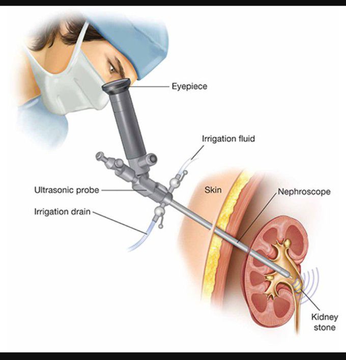 Name the procedure.