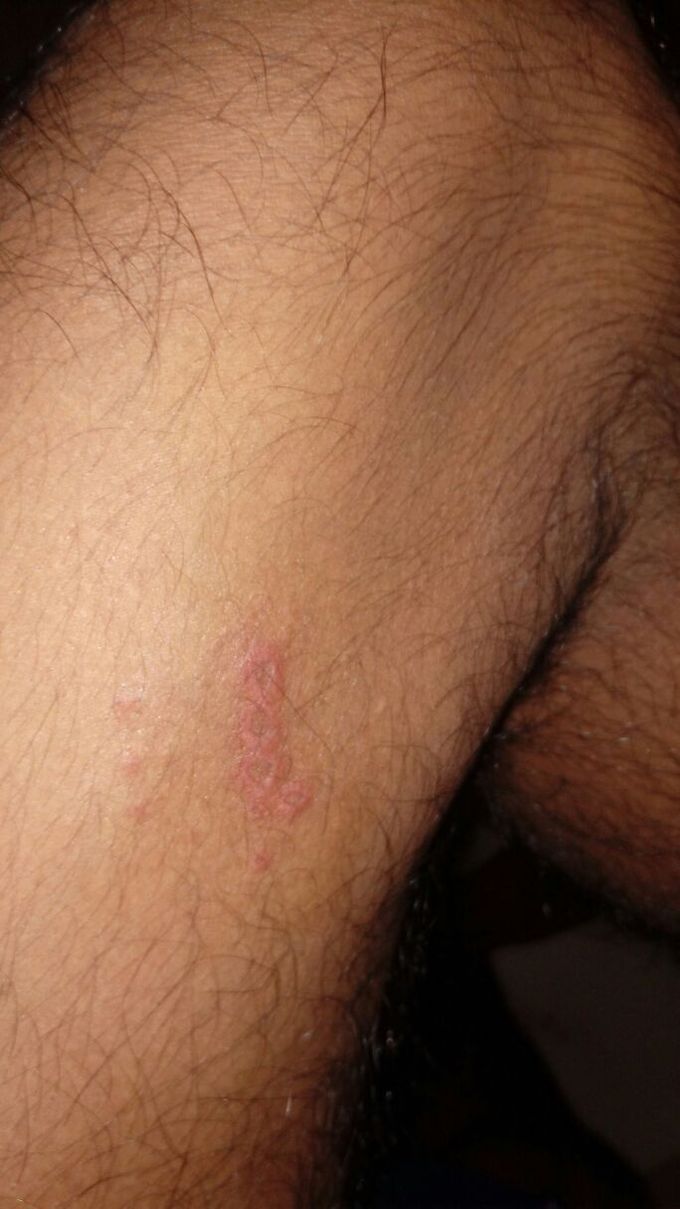 Which medicine use this disorder