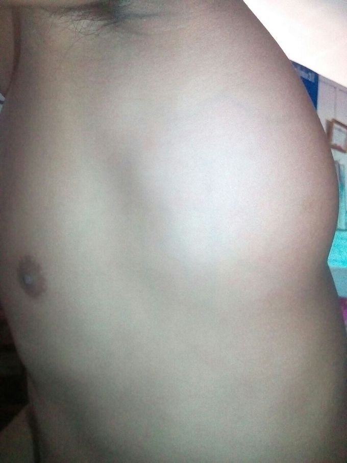 How should I diagnosis this patient