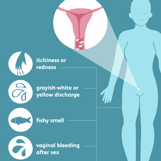 Bacterial vaginosis