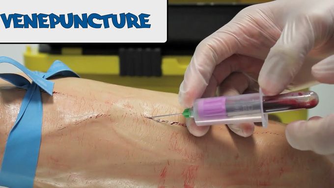 Venipuncture