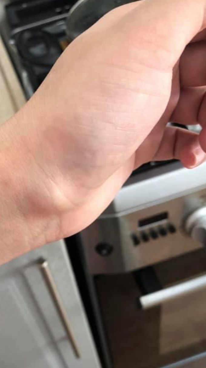 This Case