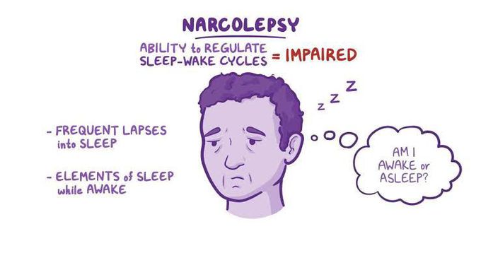 Narcolepsy