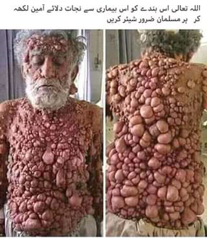 Diagnosis and treatment please