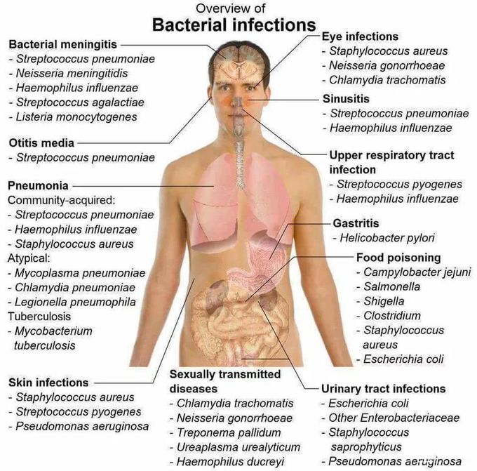 Bacterial Infections