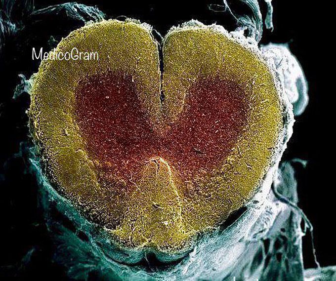 Coloured scanning electron micrograph (SEM) of a cross section through the spinal cord 