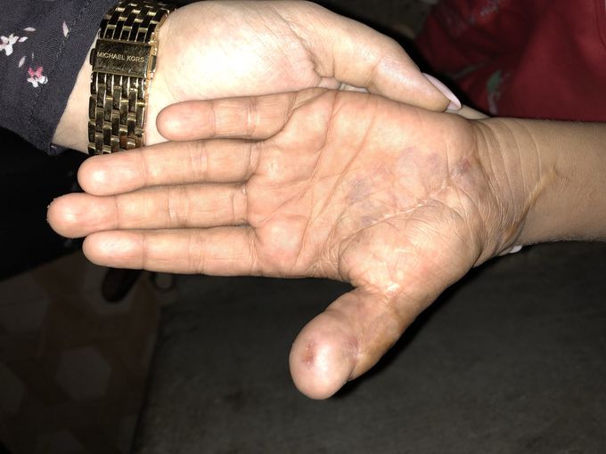 What is the diagnosis?