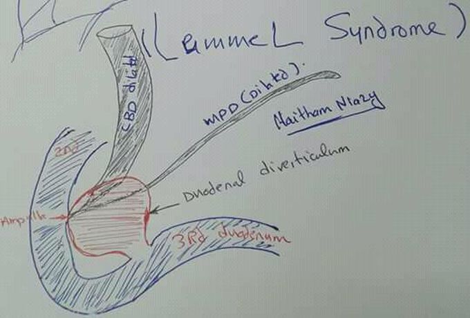 SYNDROM