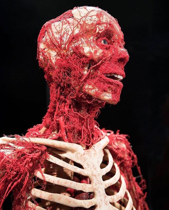 Picture  shows  blood vessels in human  head and  neck.