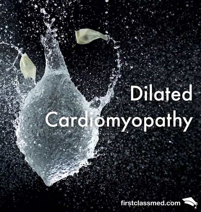 Dilated Cardiomyopathy - The fatality of an over-expanded heart