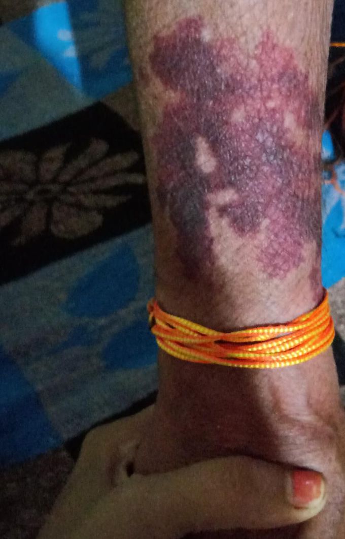 Tell me your diagnosis