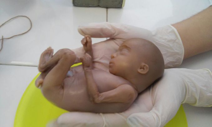 Embryology