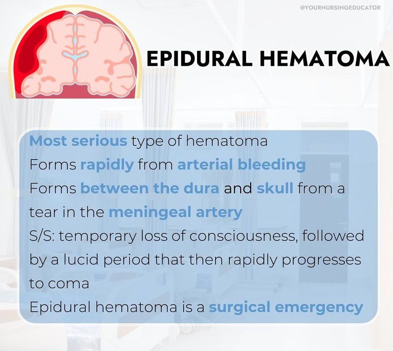 Epidural Hematoma Epidural Hemorrhage Etiology Clinical Features