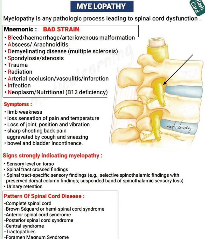 Myelopathy