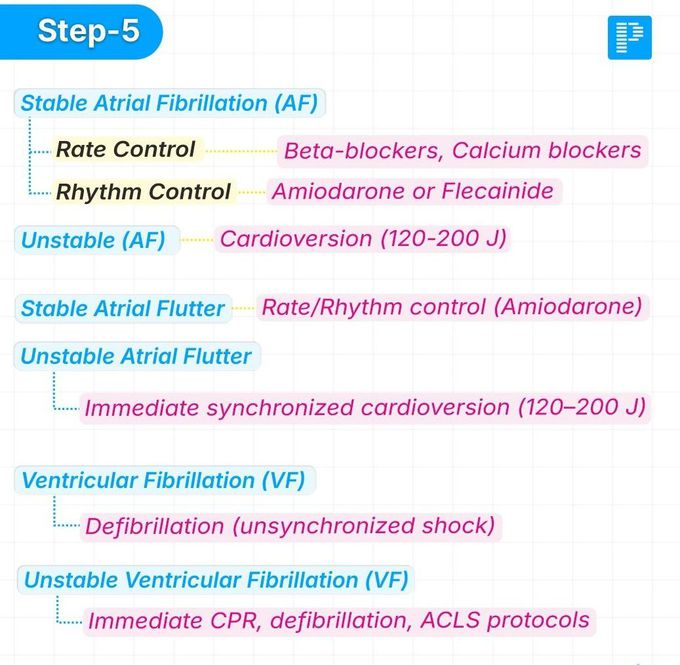Tachycardia V