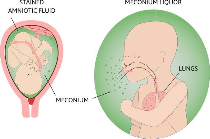 Function of meconium