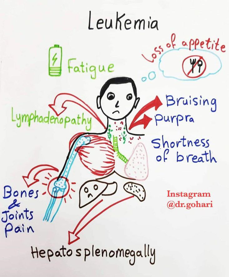 Leukemia - MEDizzy