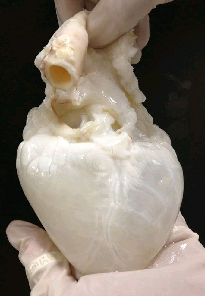 Human heart💜❤ without blood💉