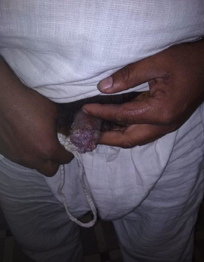 What is your diagnosis