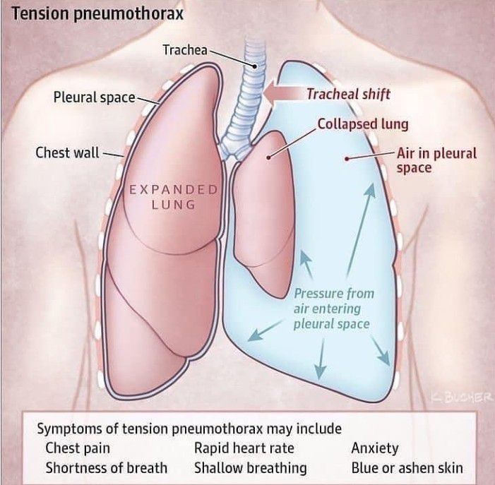 General surgery - MEDizzy