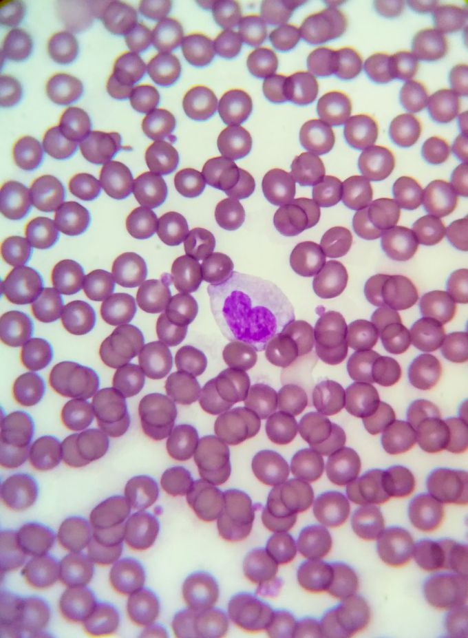 Monocyte