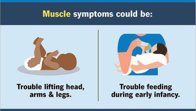 These are the symptoms of  walker warburg muscle syndrome