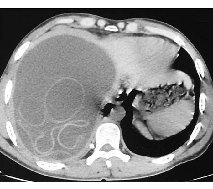 Gastroenterology
