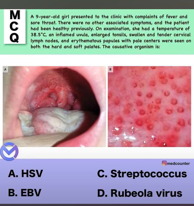 Identify the causitive organism