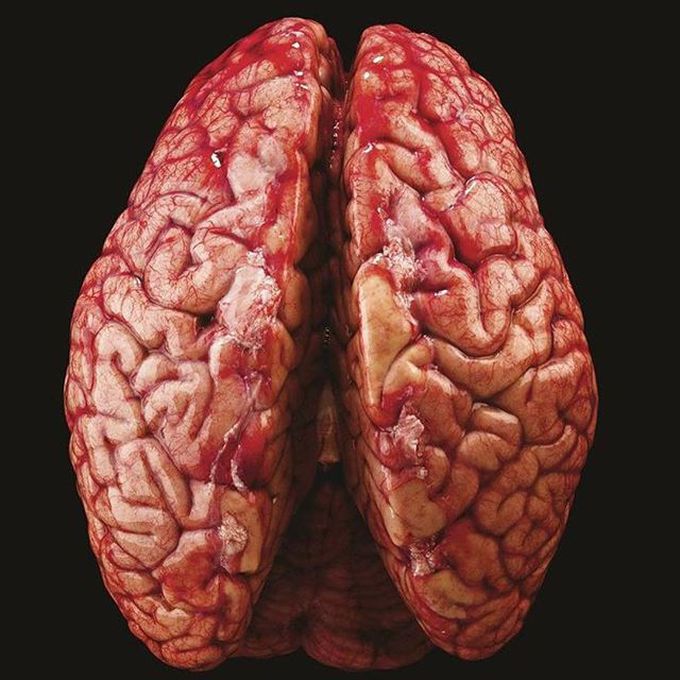 Human brain