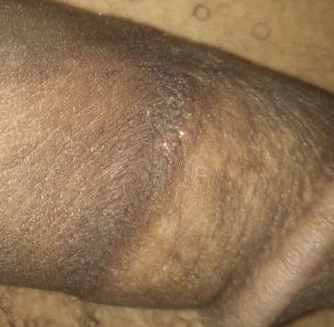 What is your diagnosis