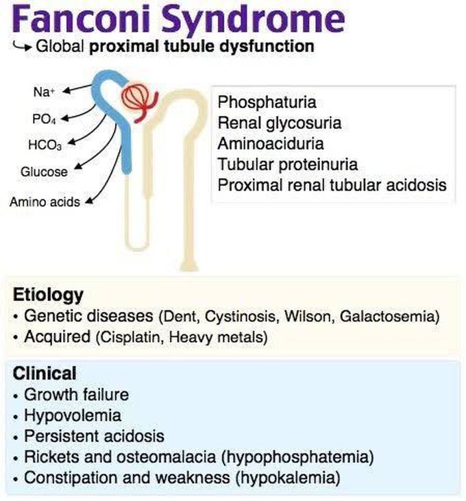 These are the clinical features of Fanconi syndrome