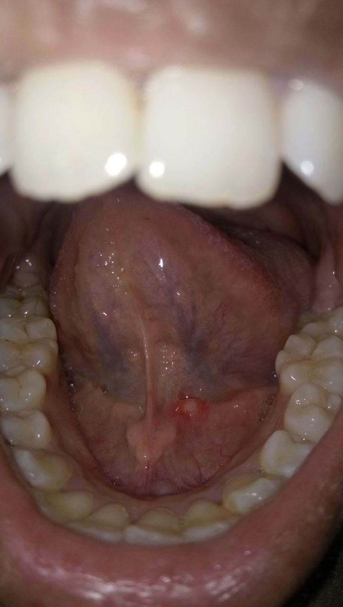 Diagnosis please