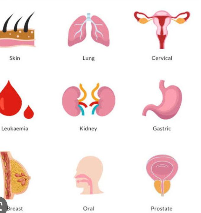 Types of Carcinoma