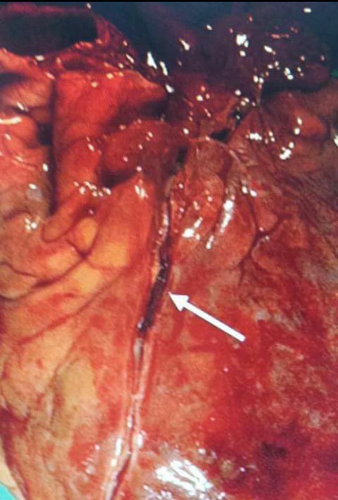 Dx and treatment please