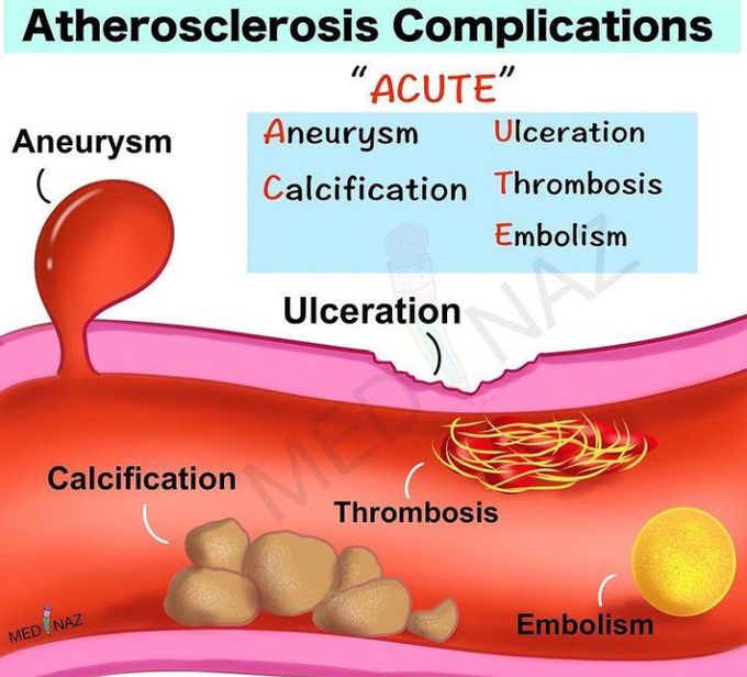 Atherosclerosis complications