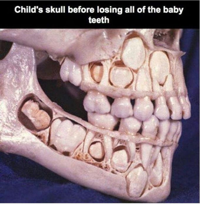 The sweetened, sugary liquids can pool around the child's teeth giving the bacteria in plaque the sugar they need to make acid and causes tooth decay. If feeding your baby at night, wipe the gums and teeth with a damp cloth, tooth wipe or toothbrush afterwards.
