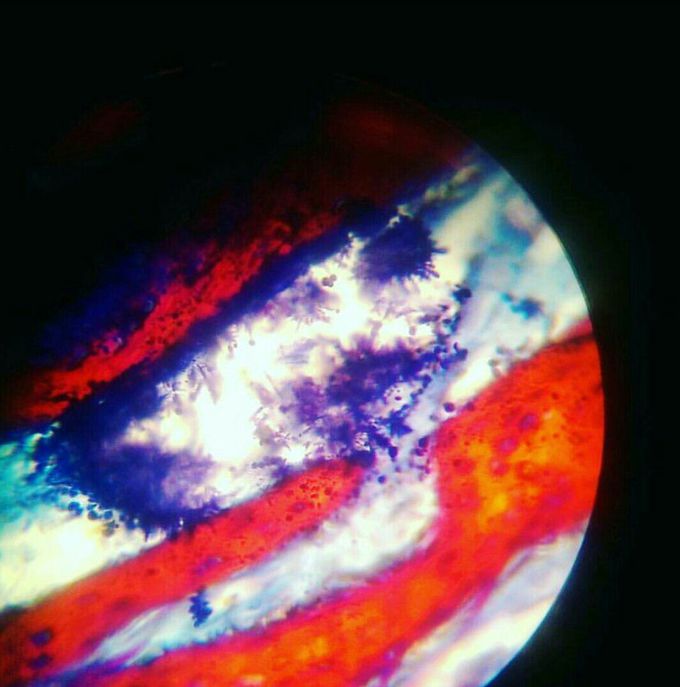 spongy bone tissue under a microscope