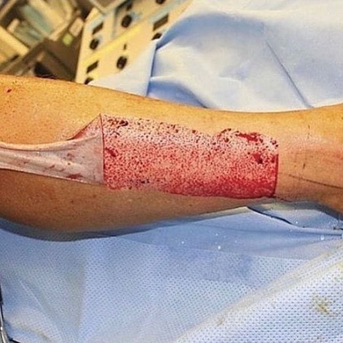 Can you name the surgical  procedures in the picture