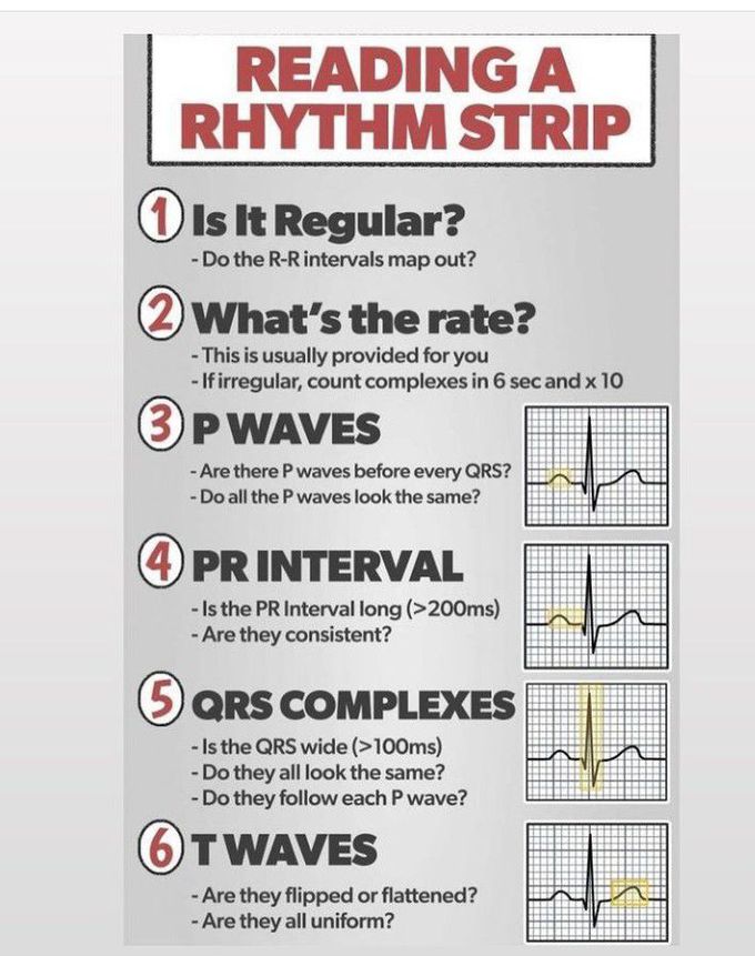 How to read the rhythm strip?