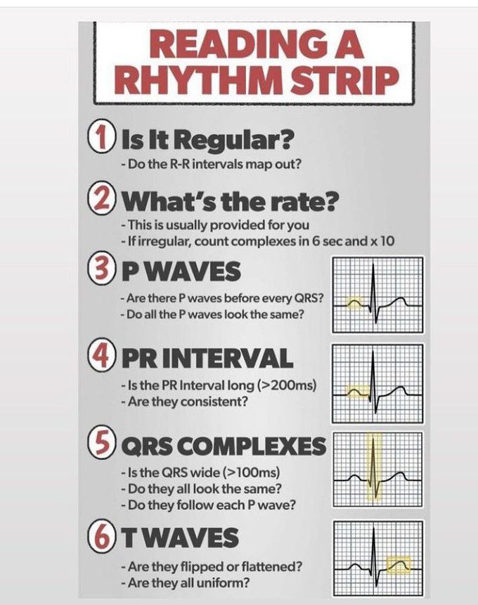 How to read the rhythm strip?
