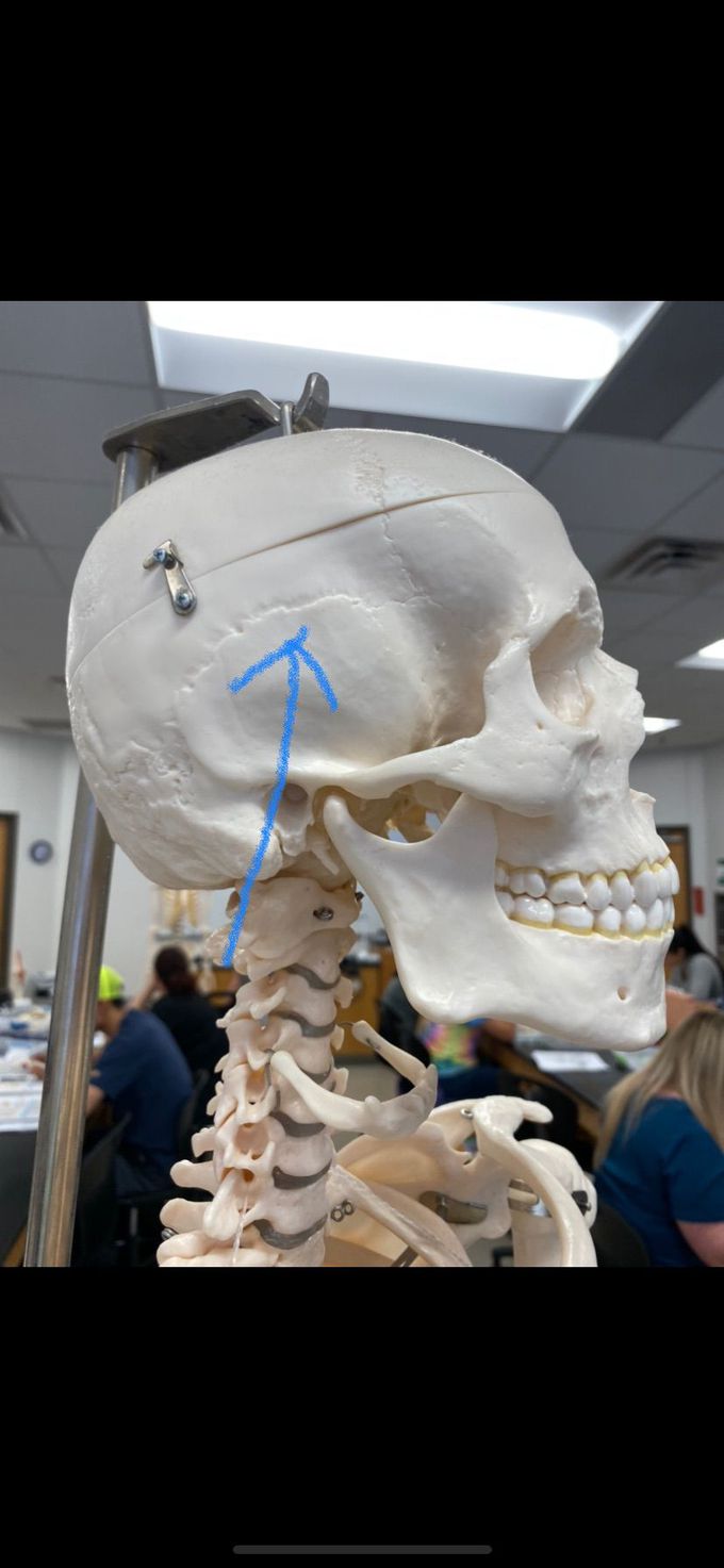 Skull