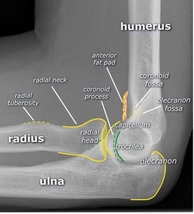 Elbow X-ray Anatomy