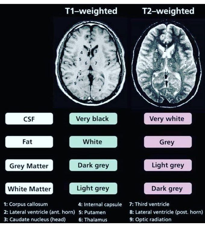 T1 weighted vs T2 weighted