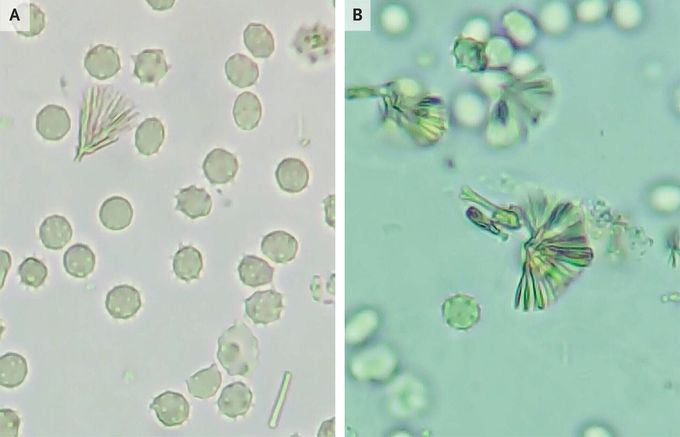 Sulfonamide Crystals