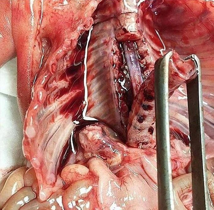 Spinal Cord of Fetus