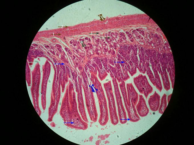 Guess what tissue is it?