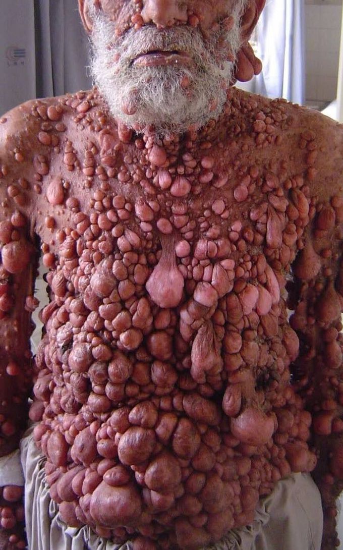 WHAT IS YOUR DIAGNOSIS.???